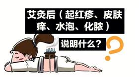  灸后身体痒，怎么办？ 