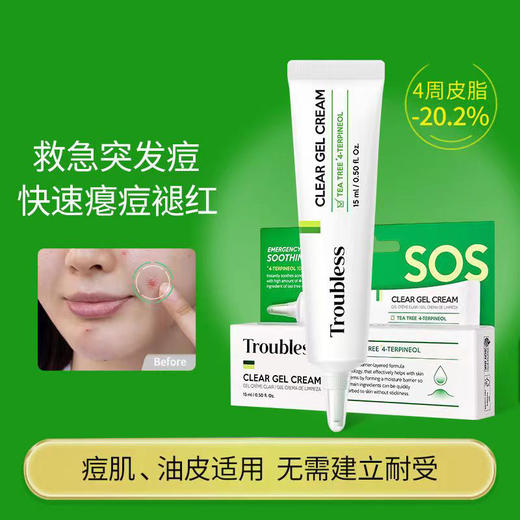 KJ 韩国 婷乐思净痘霜 15ml 淡化痘痘 精华 商品图0