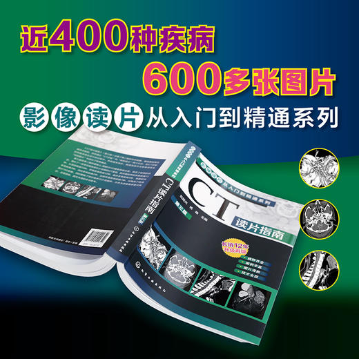 影像读片从入门到精通系列--CT读片指南（第三版） 商品图2