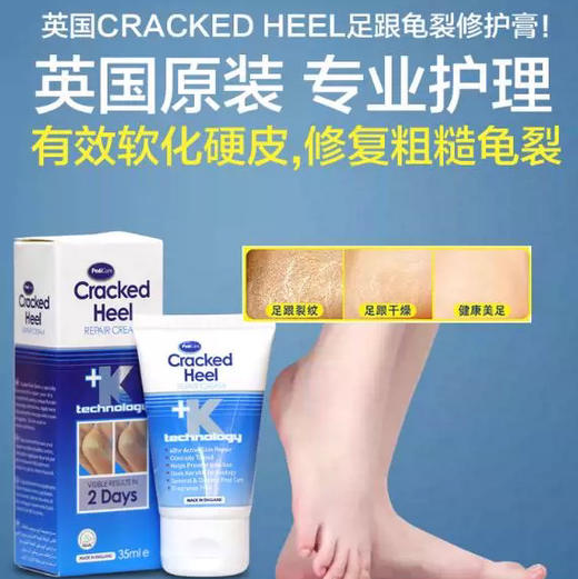 英国Cracked Heel足跟霜35ml 商品图1