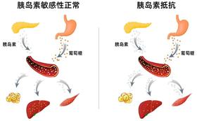 胰岛素抵抗是怎么一回事？胰岛素：我不想干了