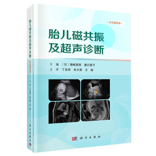 胎儿磁共振及超声诊断 胎儿MRI及超声应用价值 前置胎盘粘连或胎盘植入 侧脑室单侧扩大 绒毛膜血管瘤 科学出版社9787030767530 商品图1