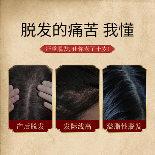 第2套减10元【持证草本防脱！姜约防脱育发液套盒】国妆特字 增发密发秀发草本生姜育发精华液防掉发育发液 商品图2