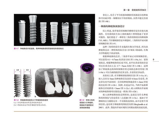 口腔种植 治疗计划与临床决策 宿玉成主译 口腔牙种植前方案设计选择讲解 种植体及相应移植方案适应证与临床效果 人民卫生出版社 商品图3