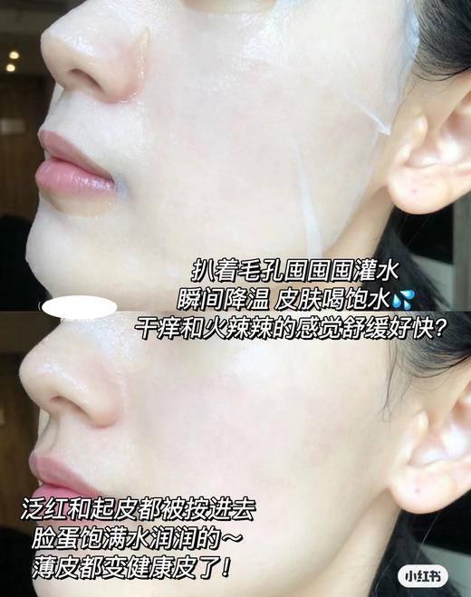 【12.3 积分当钱花】水光丰盈保湿精华面膜5片每盒*5盒（限24年3月） 商品图4