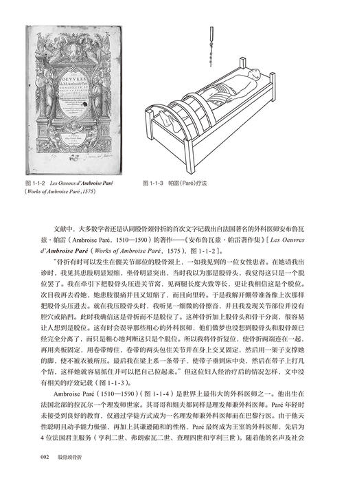 股骨颈骨折 梅炯 倪明 股骨颈骨折基础理论溯源考证及文献中实验验证临床研究 骨科临床工作者参考书 人民卫生出版社9787117347594 商品图4