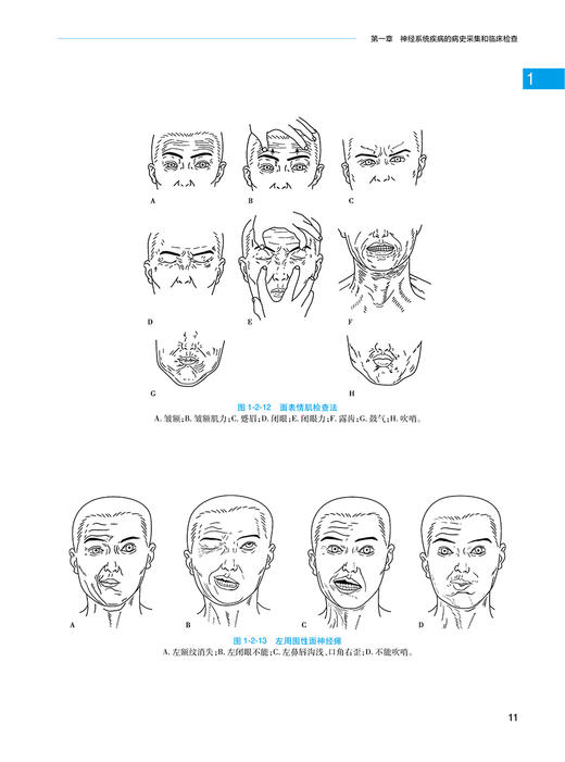 实用神经病学 黄如训 彭英 神经系统疾病临床基础辅助诊断检查原则程序 各疾病基本知识症状诊治预防 人民卫生出版社9787117353526 商品图4