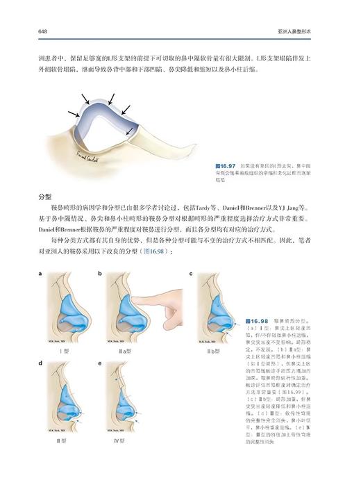 正版 亚洲人鼻整形术 徐万群主编 韩国微整形美容外科手术学 鼻整形解剖基础教程 整形医学参考书9787559126382辽宁科学技术出版社 商品图4