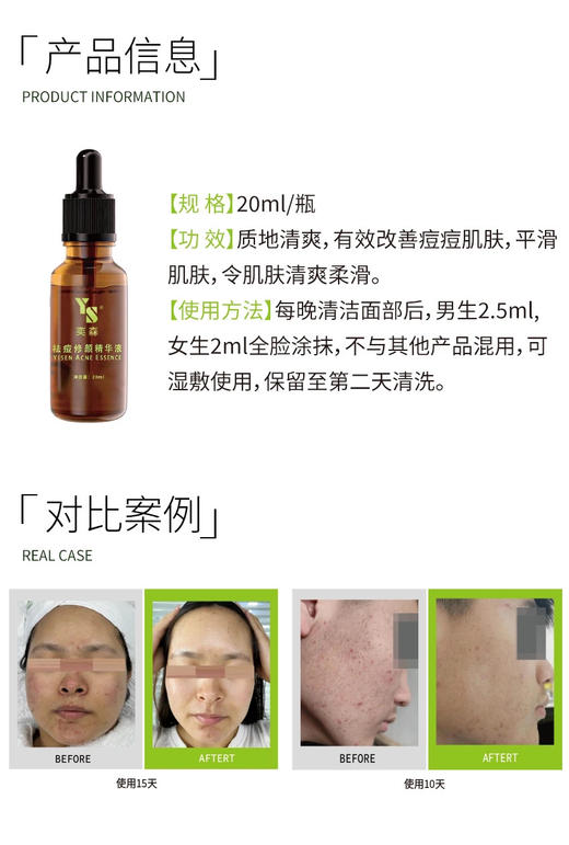 奕森祛痘精华液20ml源码正品查询防伪 商品图3