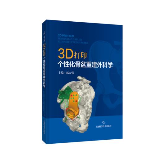 3D打印个性化骨盆重建外科学 商品图0