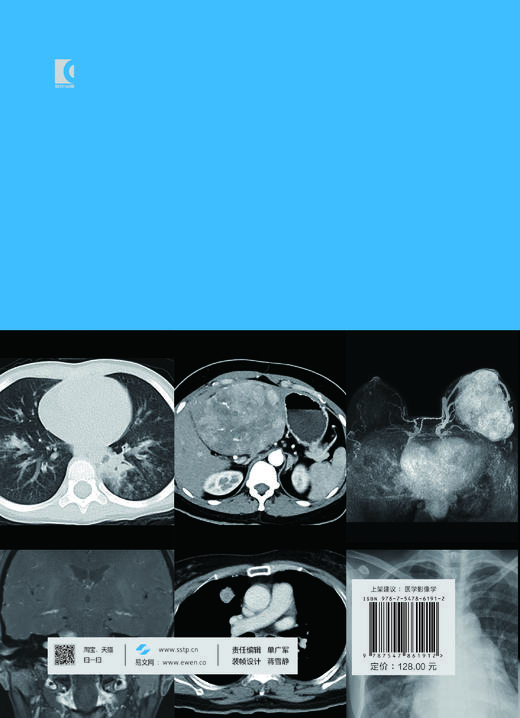影像学典型病例诊断图谱 商品图1