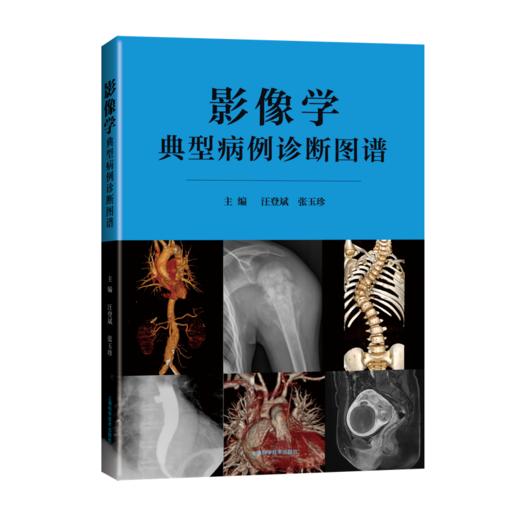 影像学典型病例诊断图谱 商品图0