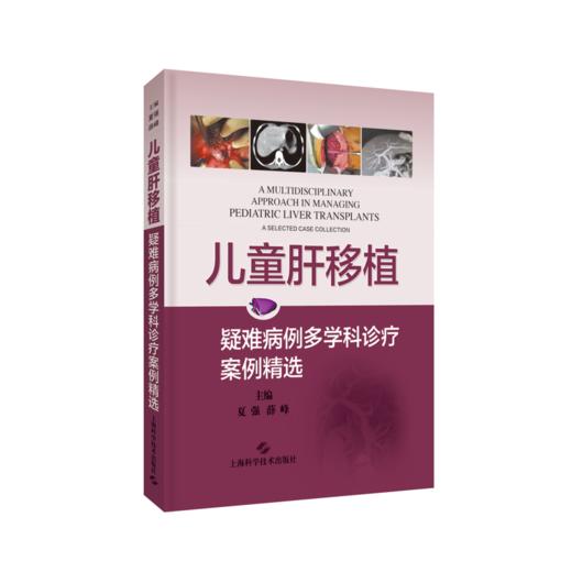 儿童肝移植：疑难病例多学科诊疗案例精选 商品图0