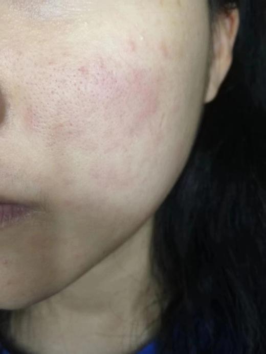  【春节现货秒杀】Physiogel霏丝佳舒缓修红安肤乳液100ml （效期至24.5） 商品图4