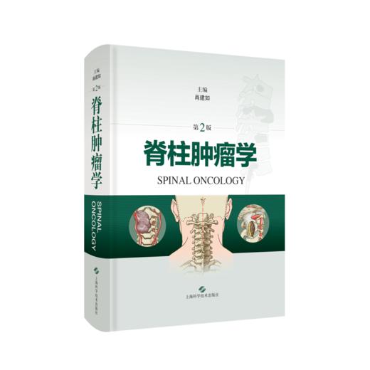脊柱肿liu学（第2版） 商品图0
