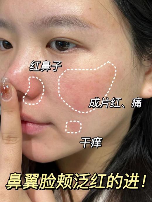  【春节现货秒杀】Physiogel霏丝佳舒缓修红安肤乳液100ml （效期至24.5） 商品图3