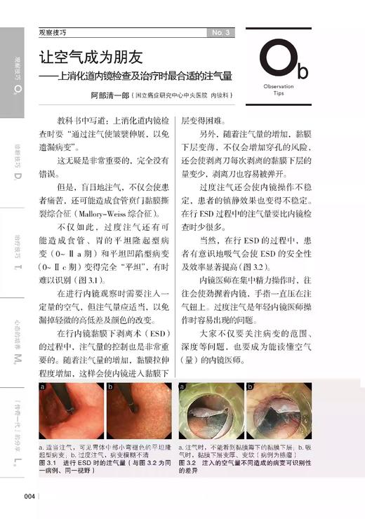 消化内镜应用提升技巧2 内镜专家未公开的观察诊断和治疗要点 赠22个中文字幕操作指导视频林香春9787571431549北京科学技术出版社 商品图3