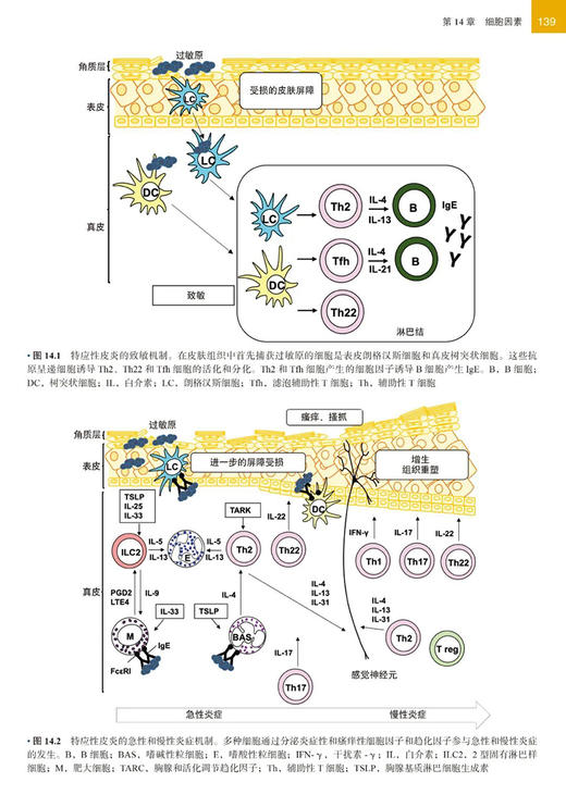 特应性皮炎 由内而外或由外而内 曾跃平主译 病理生理学分析 临床治疗方案制订实用方法 皮肤病学9787565930300北京大学医学出版社 商品图3