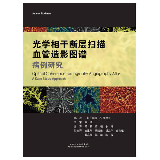 光学相干断层扫描血管造影图谱：病例研究  邵毅 谭钢 余瑶译 商品图3