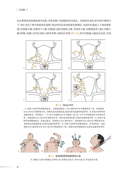 图解腔镜甲状腺手术 附视频 李超 王平 田文 外科甲状腺手术技巧注意事项 重点解剖部位术中保护切除 人民卫生出版社9787117353588 商品图4