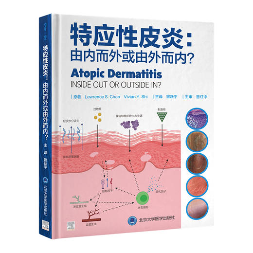 特应性皮炎 由内而外或由外而内 曾跃平主译 病理生理学分析 临床治疗方案制订实用方法 皮肤病学9787565930300北京大学医学出版社 商品图1