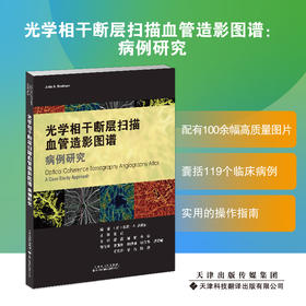 光学相干断层扫描血管造影图谱：病例研究  邵毅 谭钢 余瑶译