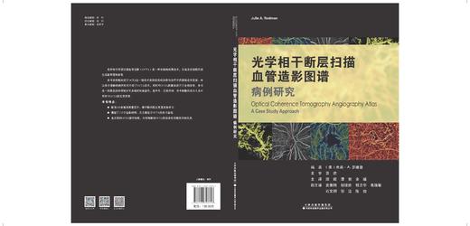 光学相干断层扫描血管造影图谱：病例研究  邵毅 谭钢 余瑶译 商品图4