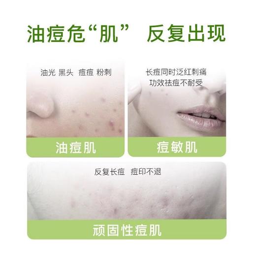 绽妍控油祛痘平衡水120ml 商品图3