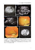 介入内镜超声 杨爱明 李连勇主译 超声相关技术操作方法步骤技巧要点 不良事件预防及处理措施 北京大学医学出版社9787565927263 商品缩略图4