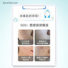 【正品直售】素姬水杨酸控油净痘精华乳祛痘痘青春痘清痘膏男女通用 商品缩略图3