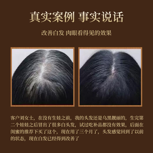 【第2瓶半价】广药白云山何首乌洗发水  500ml/瓶 商品图8