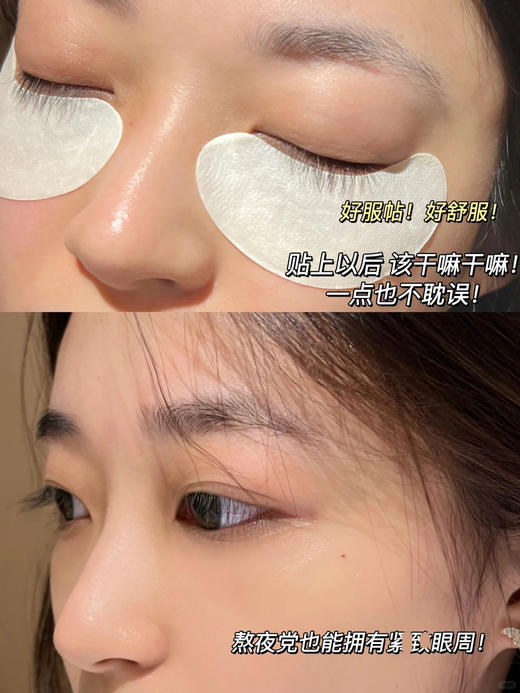 【春节不打烊】5R视黄醇酯焕颜菁采眼膜5对/盒 商品图6