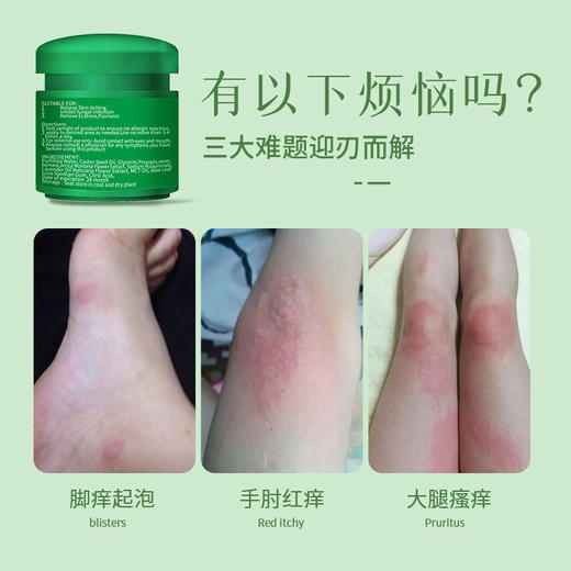 【舒缓膏】脚痒起泡、手部肿痒， HEALMUSZ舒缓膏，减少菌类、改善瘙痒、消肿、恢复受损 商品图2