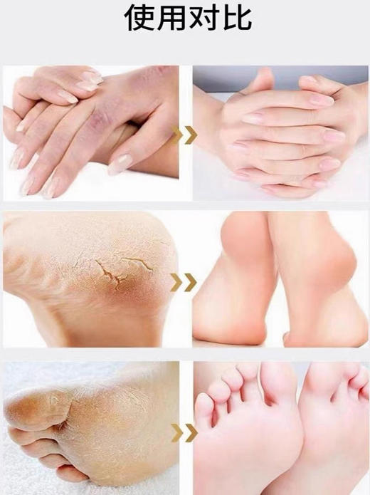 美康护肤足霜 商品图2