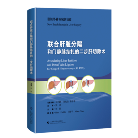 联合肝脏分隔和门静脉结扎的二步肝切除术