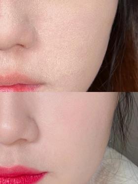 冬季的干皮宝宝们有救啦！学会这6个技巧！