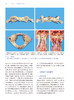 上颈椎疾病诊疗与病例精解 李浩鹏 刘忠军 艾福志 脊柱外科临床病例解析治疗原则手术入路方法要点 先进诊疗工具书 人民卫生出版社 商品缩略图3