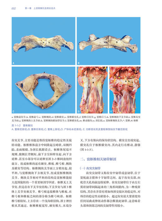 上颈椎疾病诊疗与病例精解 李浩鹏 刘忠军 艾福志 脊柱外科临床病例解析治疗原则手术入路方法要点 先进诊疗工具书 人民卫生出版社 商品图3