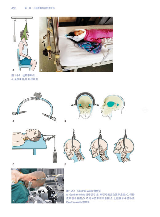 上颈椎疾病诊疗与病例精解 李浩鹏 刘忠军 艾福志 脊柱外科临床病例解析治疗原则手术入路方法要点 先进诊疗工具书 人民卫生出版社 商品图4