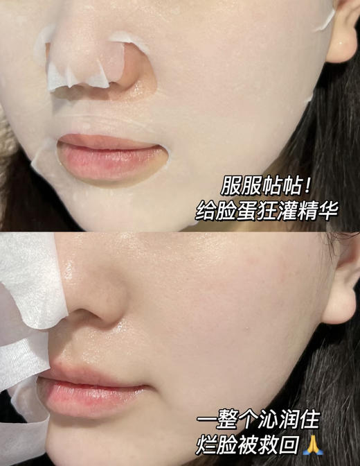 可复美透明质酸钠水润贴  大水膜补水面膜保湿5片/盒 商品图7