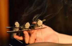  配穴并不难，搞懂配穴，艾灸事半功倍 