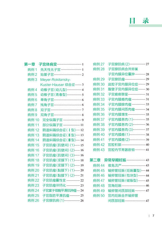 妇科疾病超声图解100例 住院医师超声医学PBL教学培训系列教程 张波 汪龙霞 董虹美 妇科精选病例典型超声表现荟萃 人民卫生出版社 商品图2