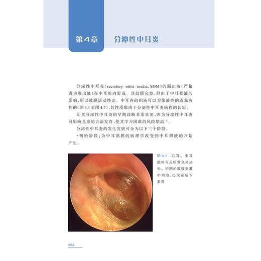 耳镜发现/国际医学研究前沿优秀译著/[斯洛文]雅奈兹·雷博尔 著/王耀文 唐世雄 译/浙江大学出版社/引进版/专著/耳鼻咽喉科 商品图3