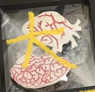 陶瓷胸针（大-两件装） 商品图0