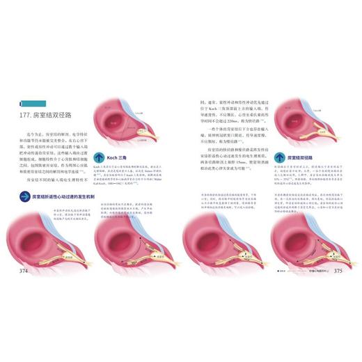 秒懂心电图百科 全彩医学插画本 商品图3
