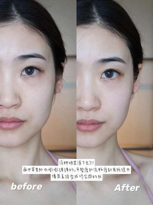 【12.24 王炸割肉价】Silkn丝可FacetiteZ Pro以色列新品射频美容仪脸部提拉紧致 商品图7