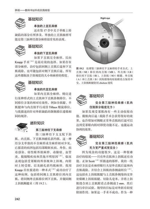 斜视 教科书以外的实践经验 丁娟 译 搭建思考斜视问题构架 斜视基础进阶知识临床经验重点误区 北京大学医学出版社9787565929229 商品图3