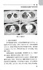 机械通气基本技术 附视频 临床专科技术培训系列教材 赵慧颖 安友仲 基础知识常用模式模拟培训 北京大学医学出版社9787565929434 商品缩略图4