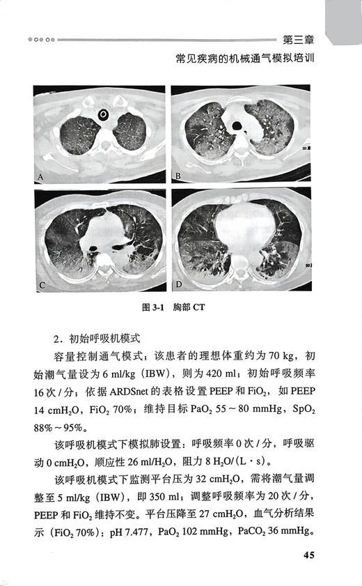 机械通气基本技术 附视频 临床专科技术培训系列教材 赵慧颖 安友仲 基础知识常用模式模拟培训 北京大学医学出版社9787565929434 商品图4