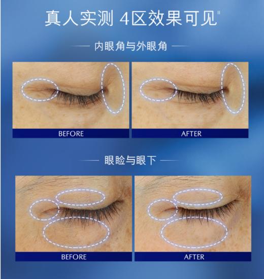 雅诗兰黛抗蓝光眼霜15ml 商品图2